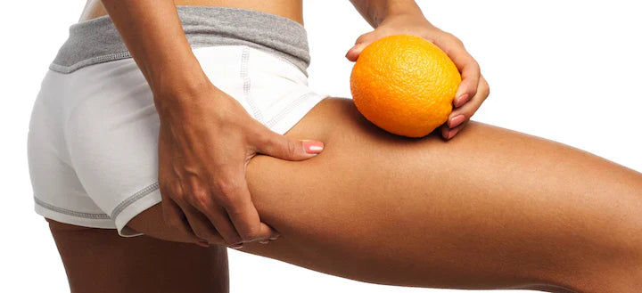 Comment lutter efficacement contre la cellulite ?